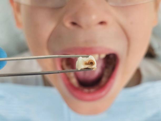 Best Orthodontic Emergency Dentist in Clinton, MO
